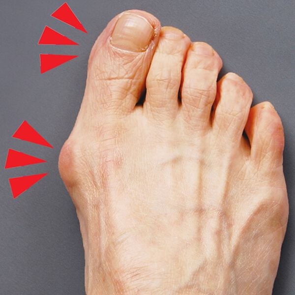 「プラスウォーク外反母趾らーく　２個入（ボディケア）」｜詳細画像