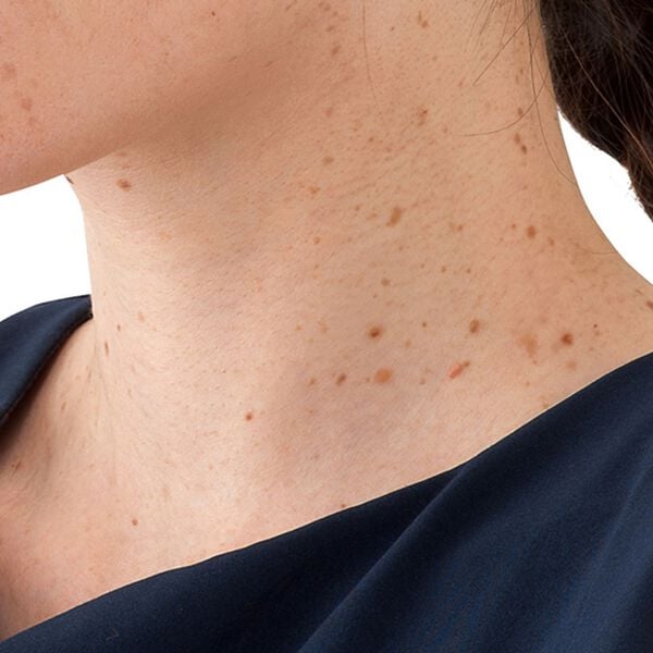 「はとむぎイポツルン習慣（フェイスケア）」｜詳細画像