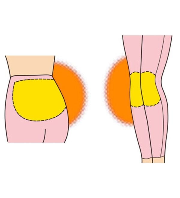 「【３色組】肌側綿１００％腰当付ボトム（肌着・インナーウェア）」｜詳細画像