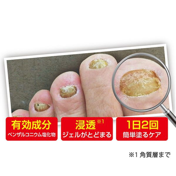 「薬用　ツメキラリ（コスメ・メイク小物）」｜詳細画像