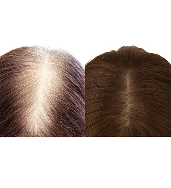 「人毛１００％白髪隠しウィッグセット（ウィッグ・ヘアピース・エクステ）」｜詳細画像