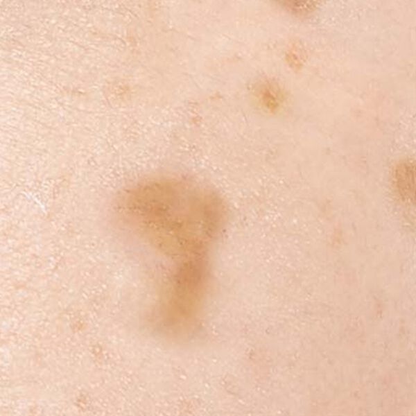 「レディブラン　薬用美白ピールホワイト　ＥＸ（フェイスケア）」｜詳細画像