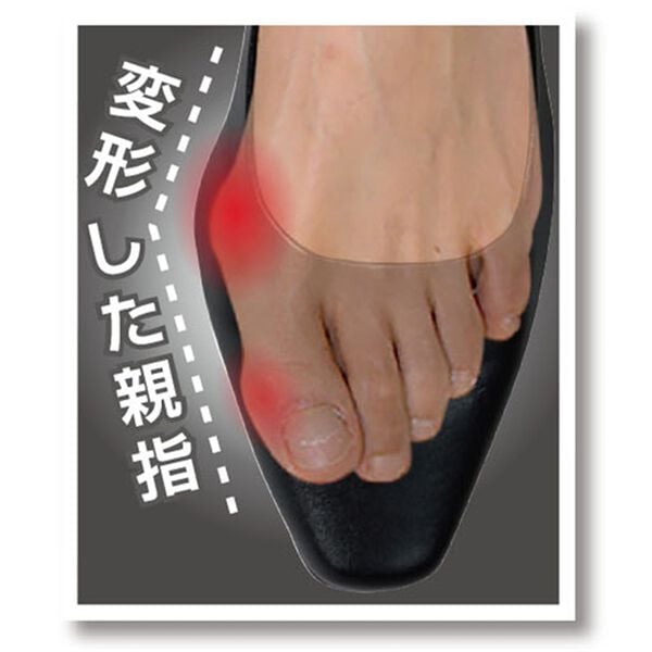 「夜用外反母趾サポーター　メディカルゆびただし（ボディケア）」｜詳細画像