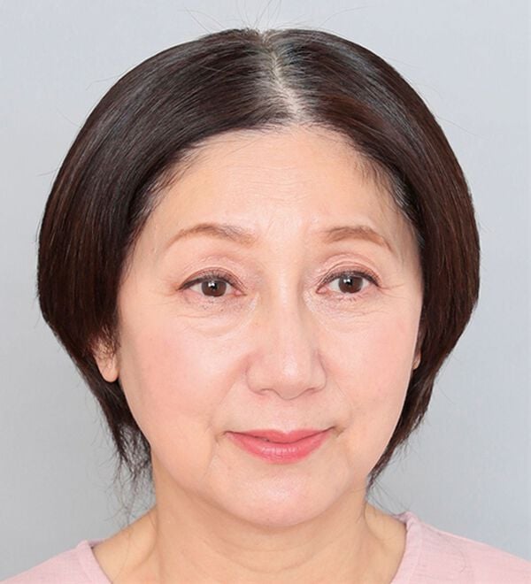 「華麗なメッシュのフルウィッグ（ウィッグ・ヘアピース・エクステ）」｜詳細画像