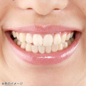 「歯のお化粧　デンタルパール（コスメ・メイク小物）」｜ナチュラルホワイト