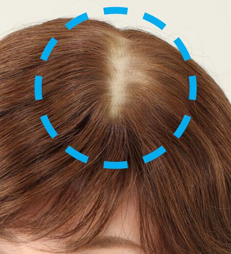 試着可能 高級人毛100％ 茶髪 ブラウン ヘアピース ウィッグ 返品OK