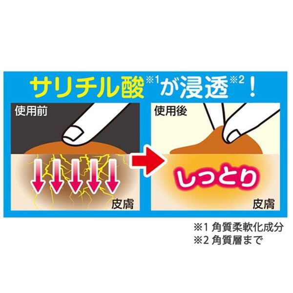 「すべっこのおまめちゃん（その他美容・健康機器）」｜詳細画像