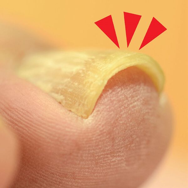 「大きく開く爪切り大小セット（コスメ・メイク小物）」｜詳細画像