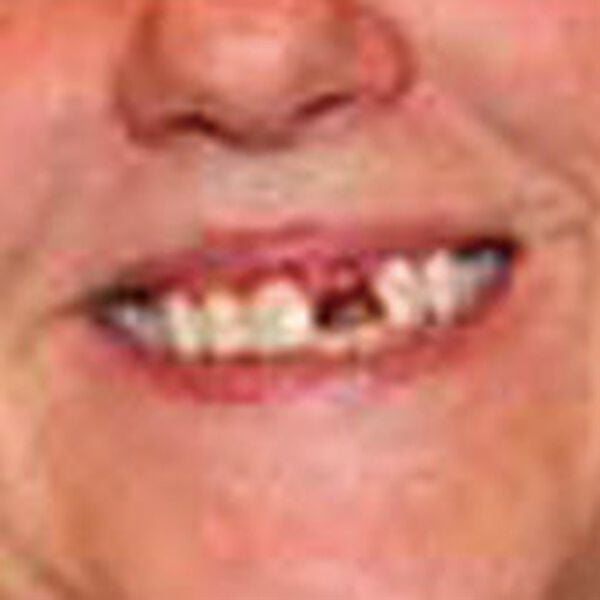 「インスタントスマイル（コスメ・メイク小物）」｜詳細画像