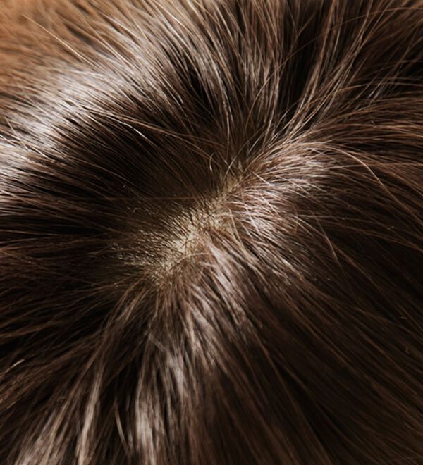 「帽子ウィッグ（もみあげ付き）カールショート　ベルーナ特別セット（ウィッグ・ヘアピース・エクステ）」｜詳細画像