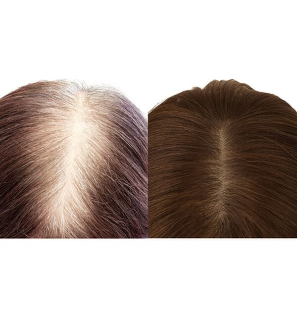 「人毛１００％白髪隠しウィッグセット（ウィッグ・ヘアピース・エクステ）」｜詳細画像