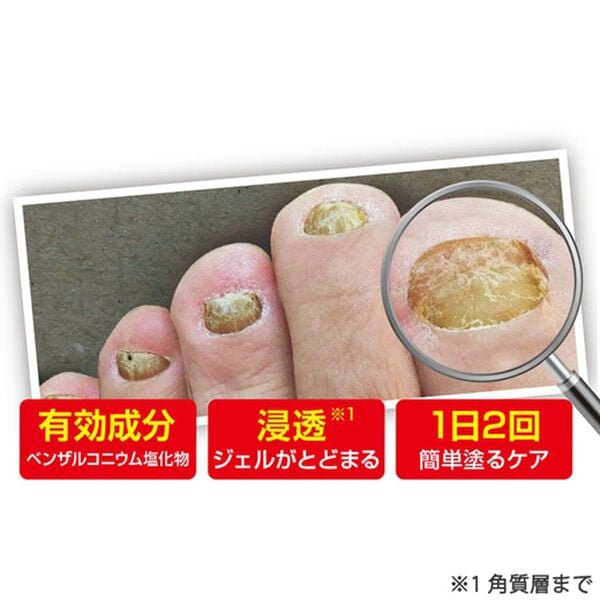 「薬用　ツメキラリ（コスメ・メイク小物）」｜詳細画像