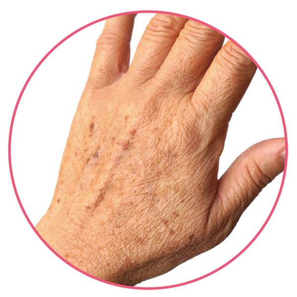 「レディブラン　薬用美白ピールホワイト　ＥＸ（フェイスケア・ボディケア）」｜詳細画像