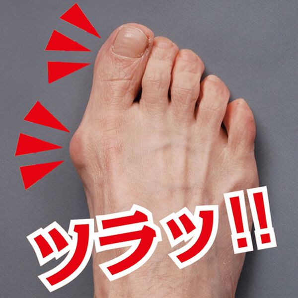 「外反母趾ベルト歩きらーく　２コ組（フェイスケア・ボディケア）」｜詳細画像