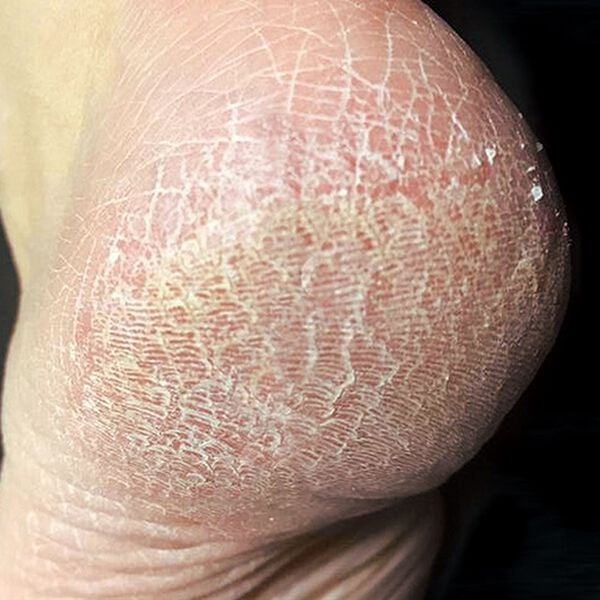 「シルク混寝てるまにモミら～く２枚組（サポーター・肩腰膝ケア）」｜詳細画像