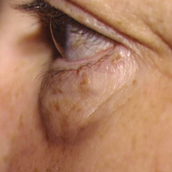 「ＮＥＷ　美女クリエイトおやすみ目袋シート（３２枚）（フェイスケア）」｜詳細画像