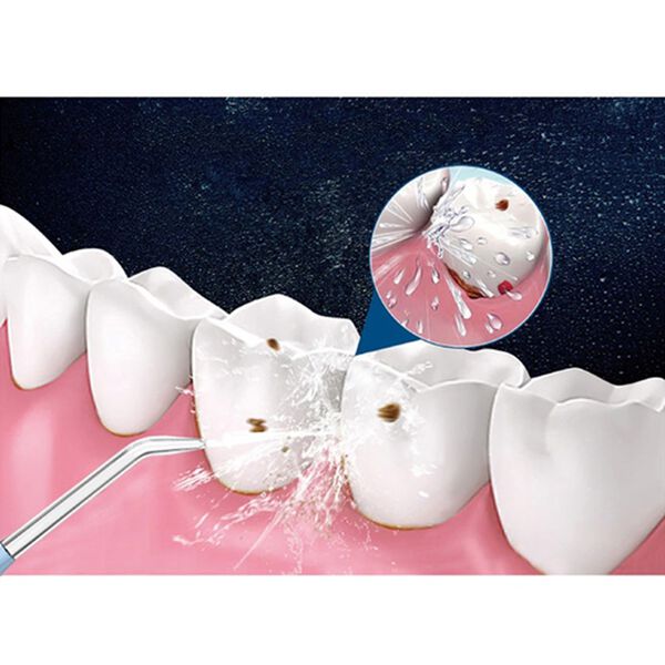 「口腔洗浄器　２個セット（その他美容・健康機器）」｜詳細画像