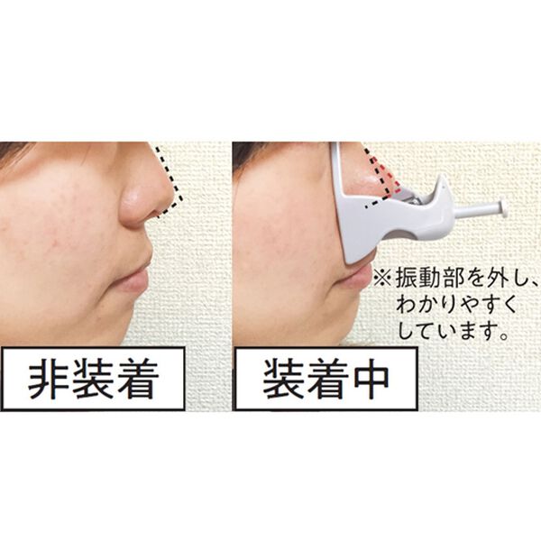 「ビューティーリフトハイノーズ　エクストラ（その他美容・健康機器）」｜詳細画像