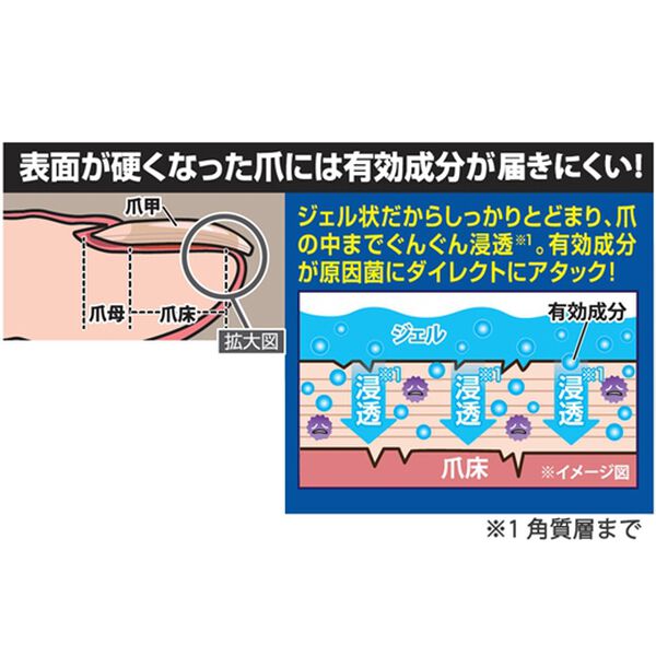 「薬用ジェル　ツメキラリ２本組（その他日用品）」｜詳細画像